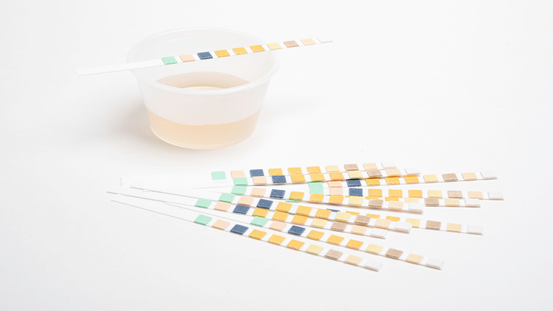 Signs of Diabetic Ketoacidosis in Children - Gluroo