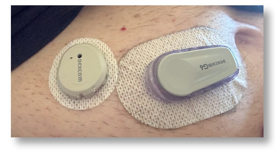 Dexcom Patch Review: How to Make Your CGM Stay on Longer