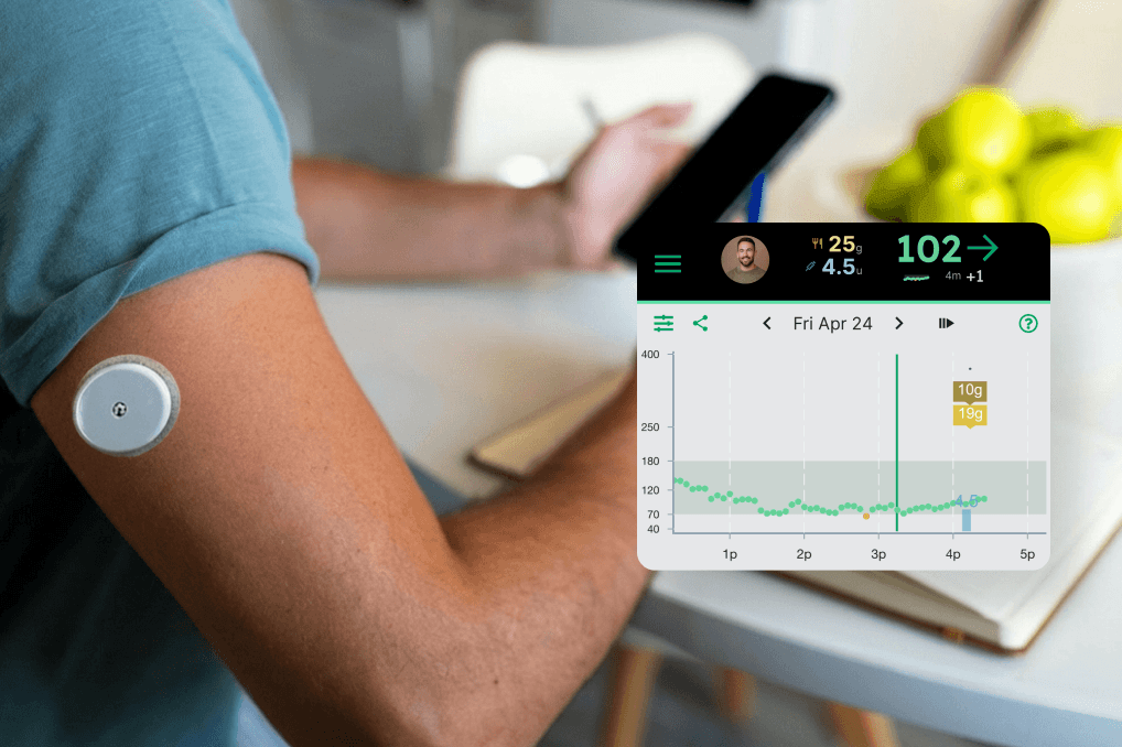 Adult man with a CGM looking at his glucose chart on Gluroo
